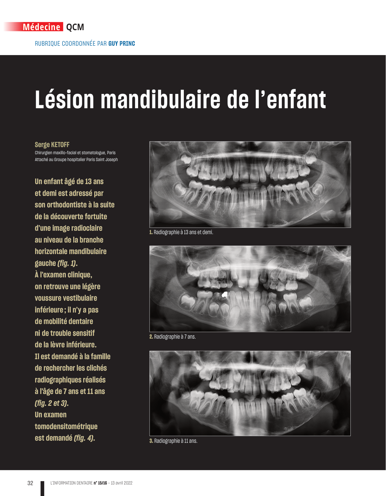 La chirurgie maxillo-faciale en QCM — Ellipses (ouvrage) 2016 (première page)