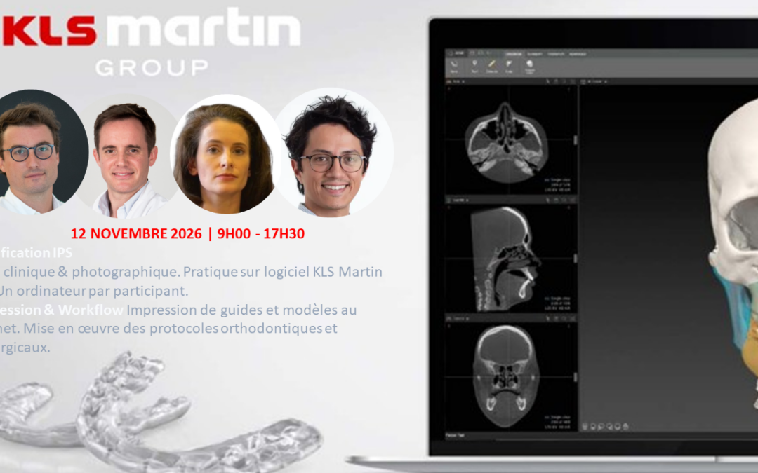 Planification 3D et impression au cabinet en chirurgie orthognathique