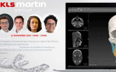 Planification 3D et impression au cabinet en chirurgie orthognathique
